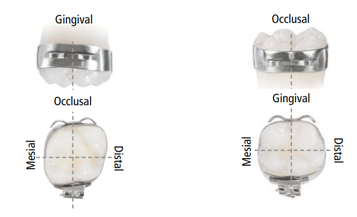 Molar Lingual Button without Hooks